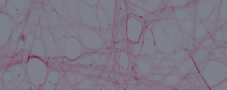 TrackCore Inc. Awarded Contract by Vizient for an Industry Leading Tissue & Implant Tracking Solution