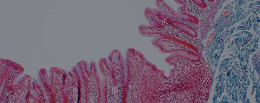 RFID For Ensuring Integrity For Medical Tissues and Devices