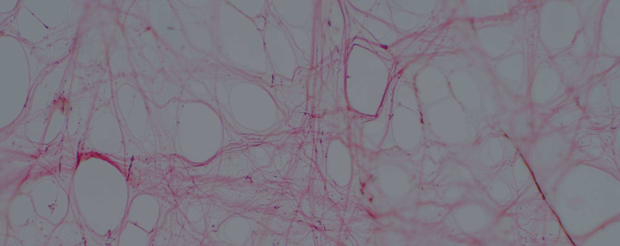 TrackCore Inc. Awarded Contract by Vizient for an Industry Leading Tissue & Implant Tracking Solution